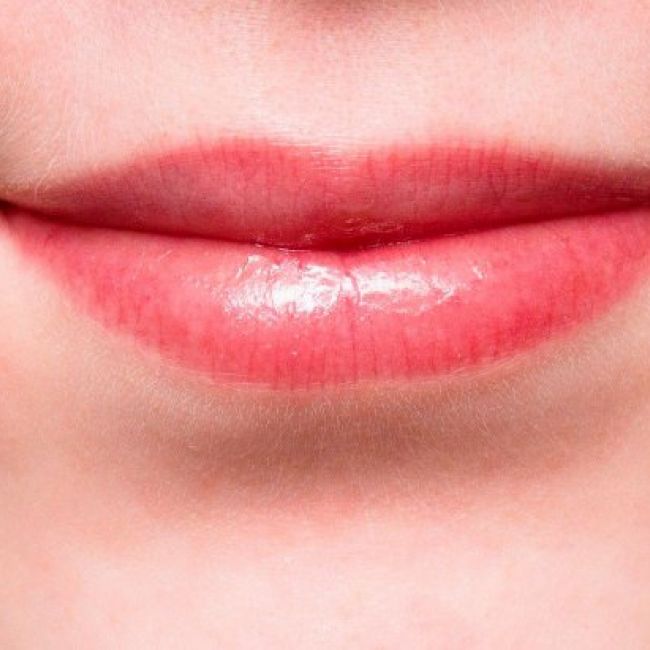 Estética labial